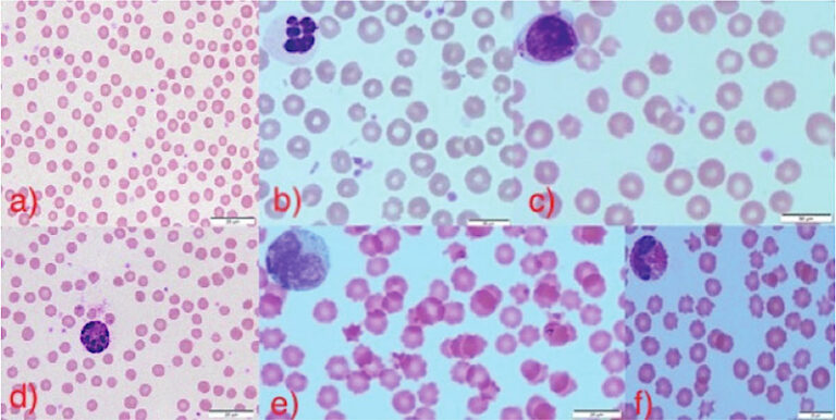 Hemogram in cattle - understanding normal values and variations ...